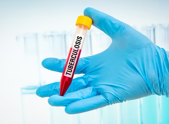 TB-PCR Test